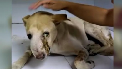 Photo of Tumor Made Him Cry Pus & No One Would Touch Him Till God Sent Him His Way