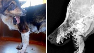 Photo of Her Jaw Broke After Being Kicked, She Couldn’t Eat But People Ignored Her Pain